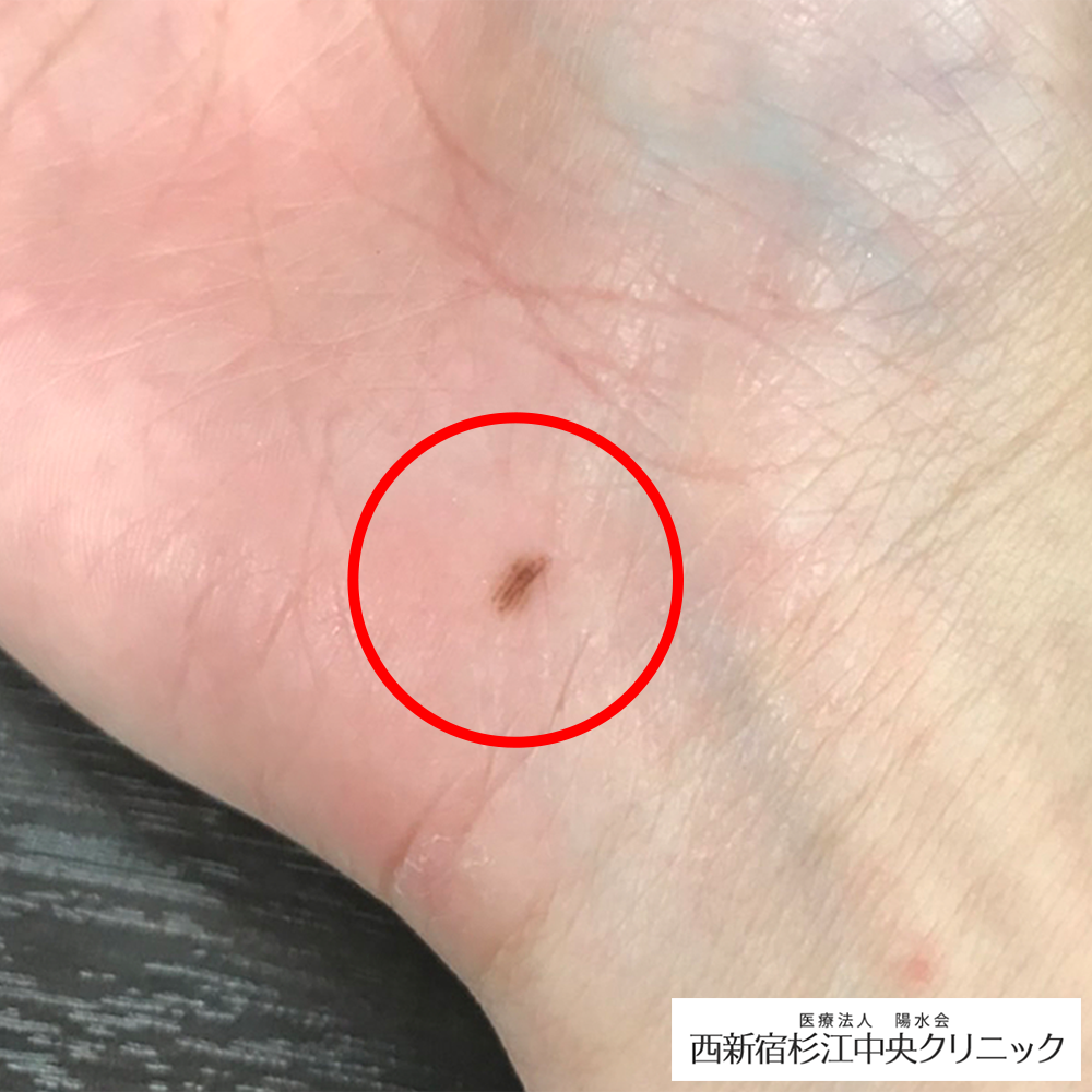 症例写真