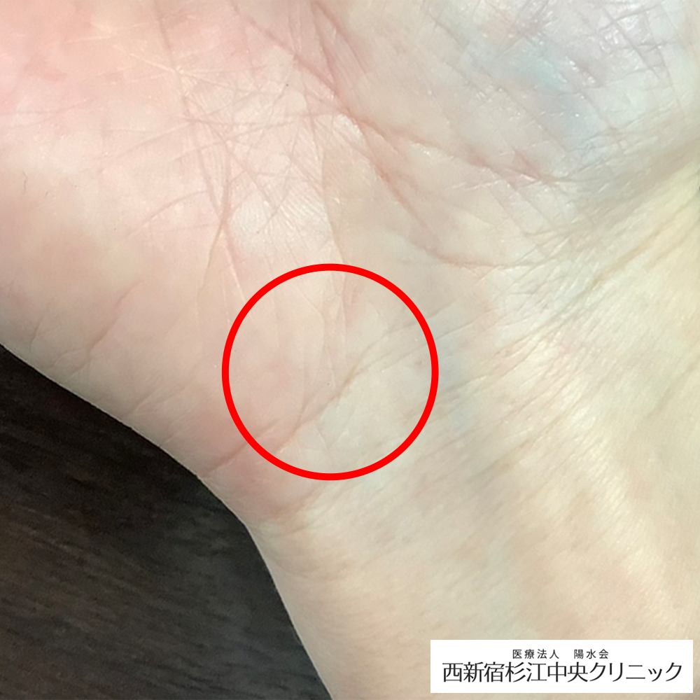 症例写真